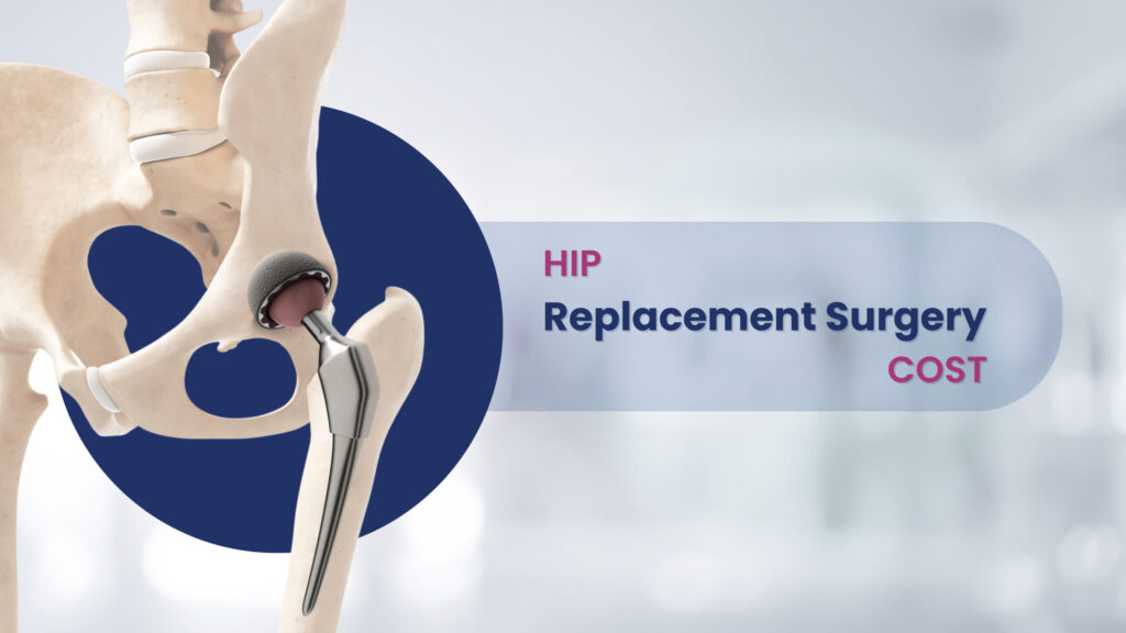 Hip replacement surgery in India