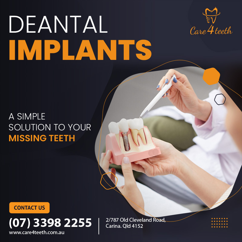 Dental Implant in Brisbane – Care 4 Teeth